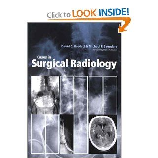 Cases in Surgical Radiology: 9780632058228: Medicine & Health Science Books @
