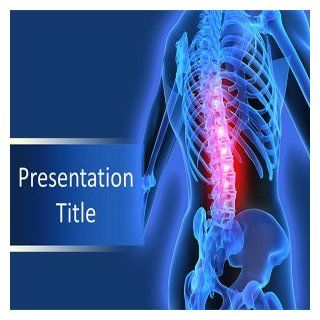 Back Pain Powerpoint Templates   Back Pain Powerpoint (Ppt) Templates: Software