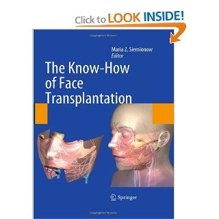 The Know How of Face Transplantation (9780857292520): Maria Z. Siemionow: Books