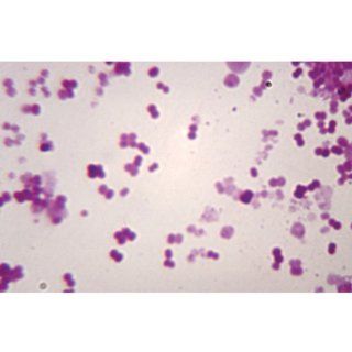Haemophilus influenzae, w.m., Microscope Slide: Industrial & Scientific