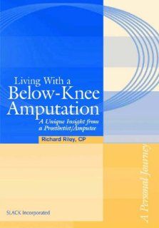 Living with a Below Knee Amputation: A Unique Insight from a Prosthetist/Amputee: 9781556426926: Medicine & Health Science Books @