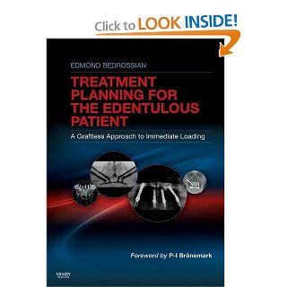 Implant Treatment Planning for the Edentulous Patient: A Graftless Approach to Immediate Loading, 1e: 9780323073684: Medicine & Health Science Books @