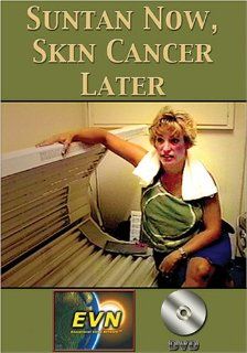 Suntan Now, Skin Cancer Later DVD: Artist Not Provided: Movies & TV