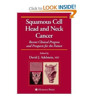 Squamous Cell Head and Neck Cancer: Recent Clinical Progress and Prospects for the Future (Current Clinical Oncology): 9781588294739: Medicine & Health Science Books @