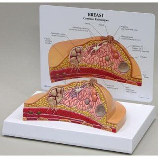 Breast Cross Section Anatomical Classroom Educational Model CEM: Industrial & Scientific