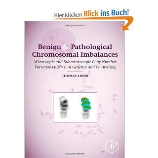 Benign & Pathological Chromosomal Imbalances: Microscopic and Submicroscopic Copy Number Variations Cnvs in Genetics and Counseling: Thomas Liehr: Fremdsprachige Bücher